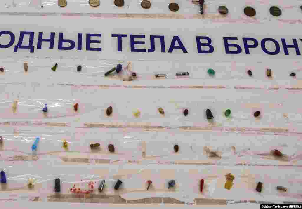 Балдардын өпкө, ашказан, ичегилеринен чыккан майда нерселер. 