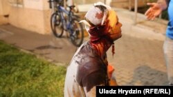 Пацярпелы падчас пратэстаў 10 жніўня 2020
