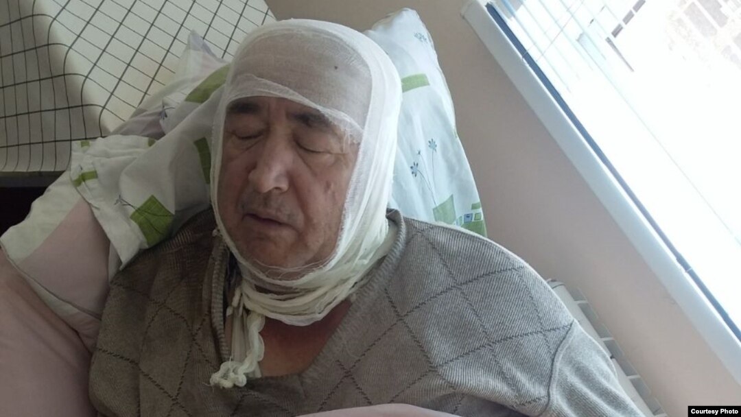 Olim Mustafoev, the father of
Muqaddas Mustafoeva, suffered burns when he intervened after his daughter set herself on fire.